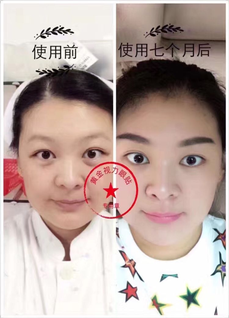 黄金视力眼贴反馈