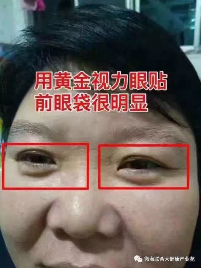 黄金视力眼贴反馈